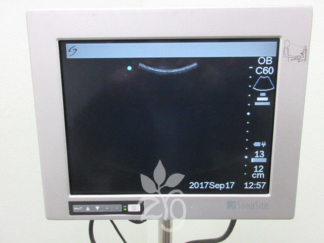 SonoSite 180 Plus Portable Ultrasound on Stand w 2 Probes, Printer and Monitor DIAGNOSTIC ULTRASOUND MACHINES FOR SALE