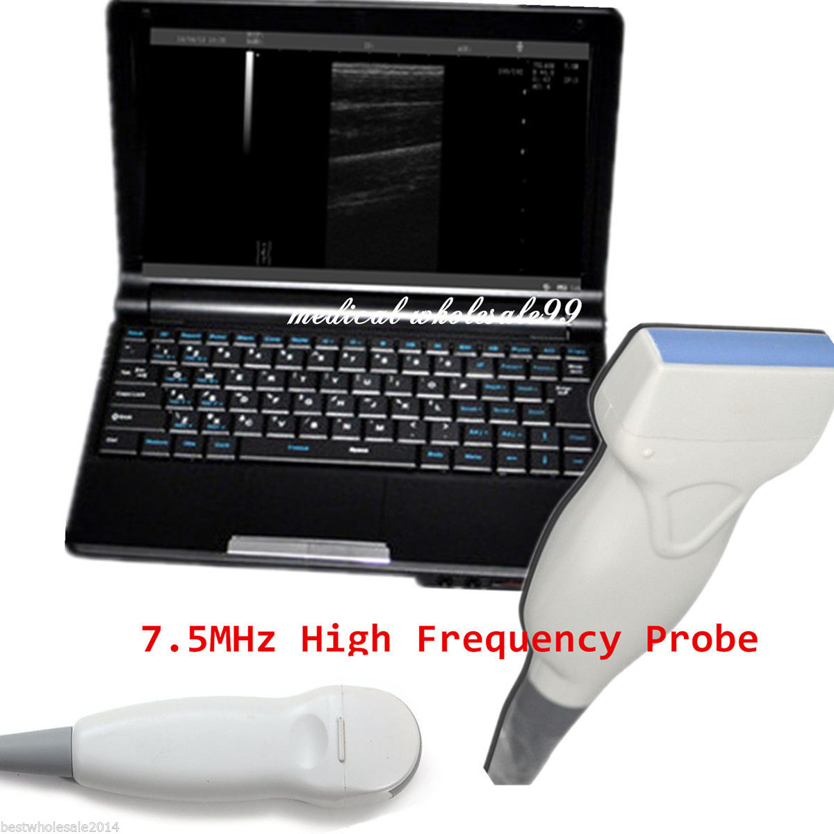 10.1 Ultrasound Scanner Diagnostic Machine Micro-Convex + linear Probe USB port DIAGNOSTIC ULTRASOUND MACHINES FOR SALE