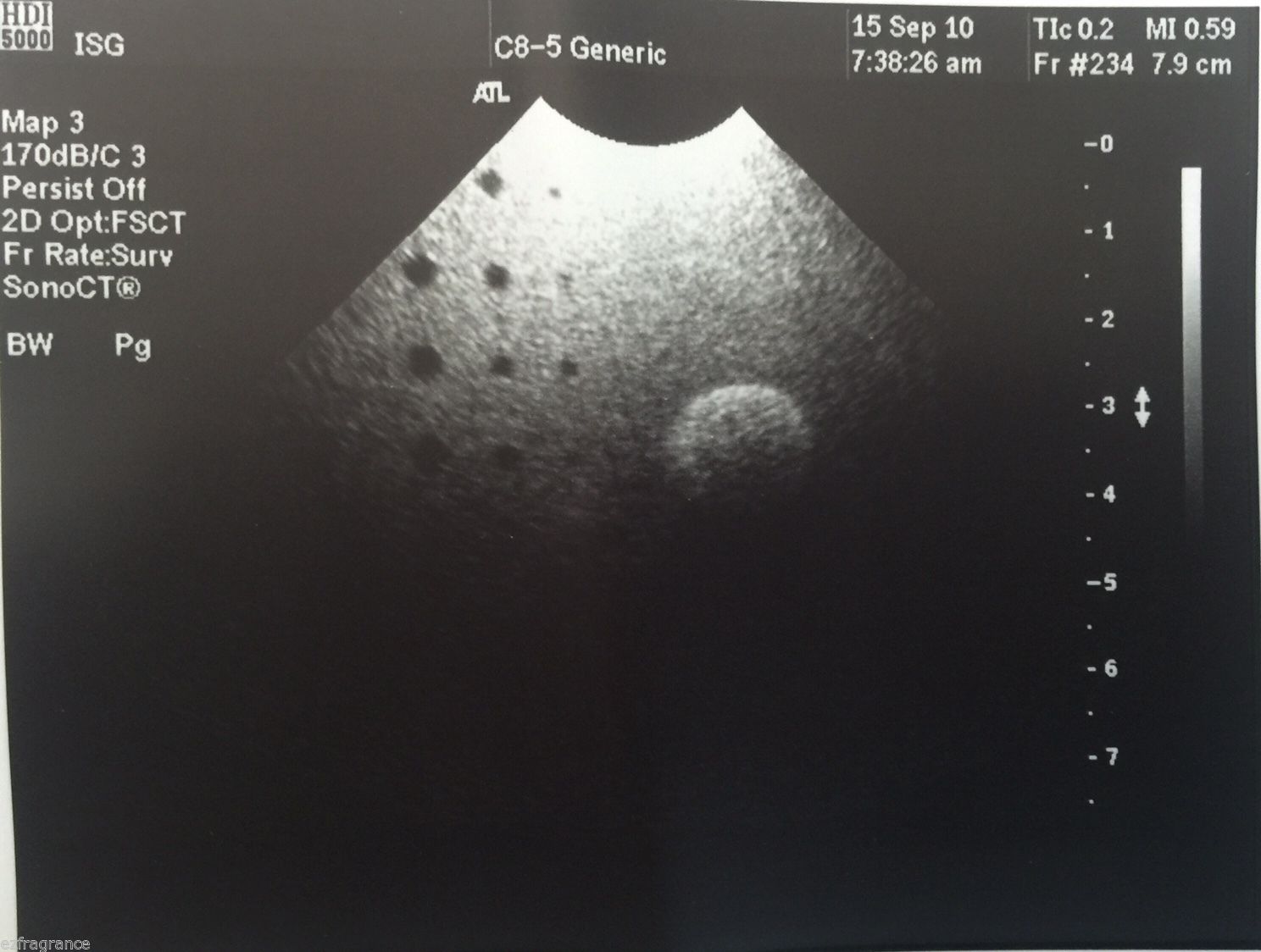 Philips ATL C8-5 14R Broadband Curved Array Transducer Ultrasound Probe.USED DIAGNOSTIC ULTRASOUND MACHINES FOR SALE