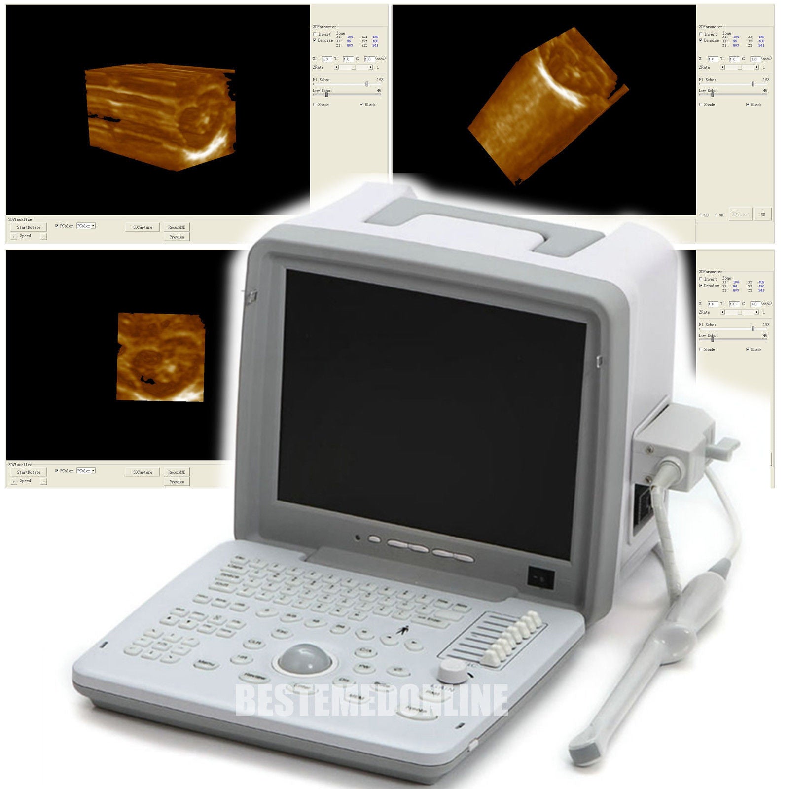 super top Full Digital Ultrasound Scanner Transvaginal probe external 3D image DIAGNOSTIC ULTRASOUND MACHINES FOR SALE