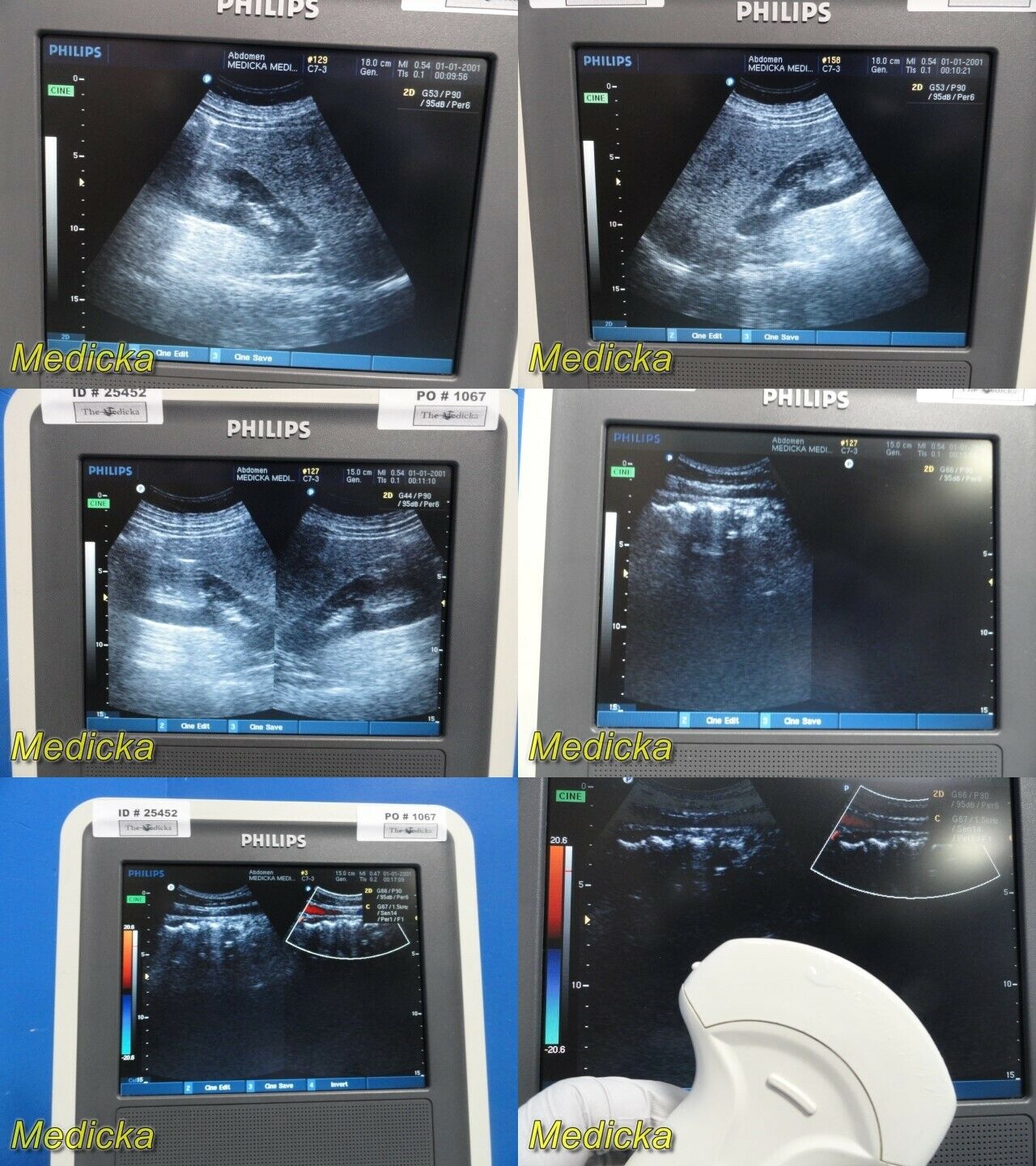 Philips HD3(HD3-Exp) Ultrasound System W/ C7-3 Convex Probe, Printer & PSU~25452 DIAGNOSTIC ULTRASOUND MACHINES FOR SALE