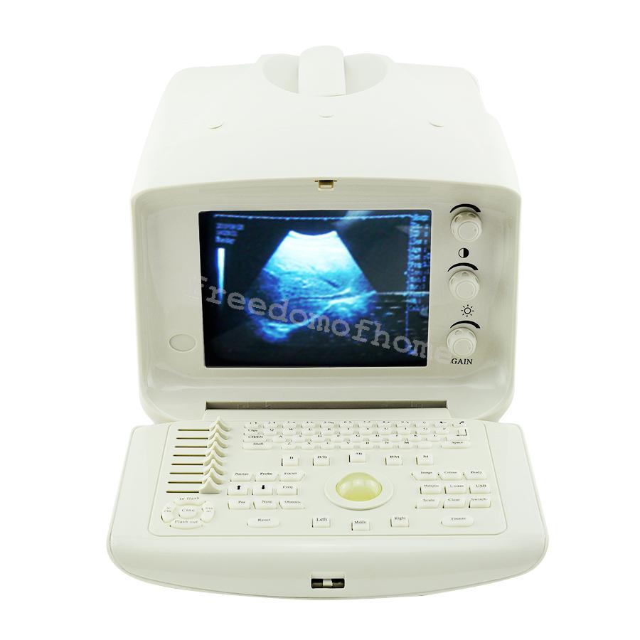 Full Digital Portable Ultrasound Scanner machine +Convex + Vignial  2 Probes+3D DIAGNOSTIC ULTRASOUND MACHINES FOR SALE