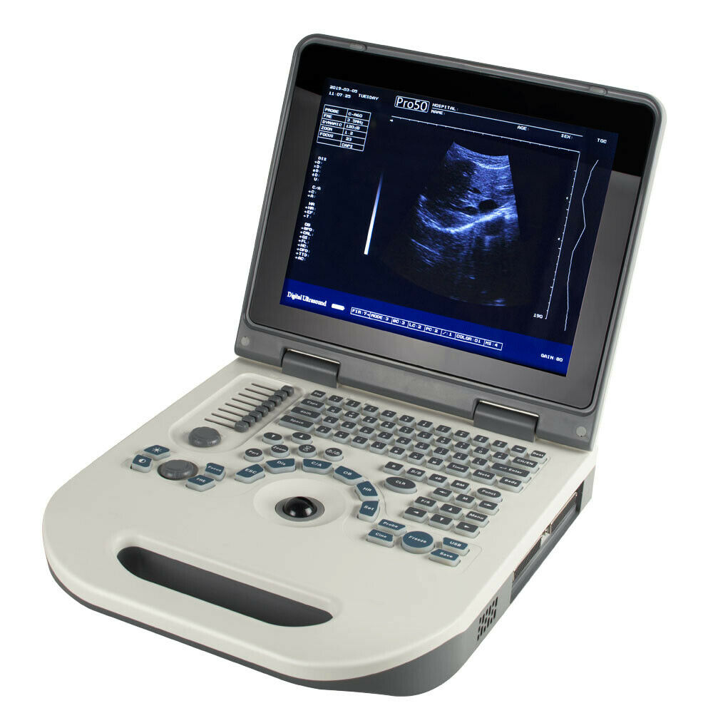 Portable Digital Ultrasound Scanner machine Abdomen Baby Convex Probe + 3D Pack DIAGNOSTIC ULTRASOUND MACHINES FOR SALE