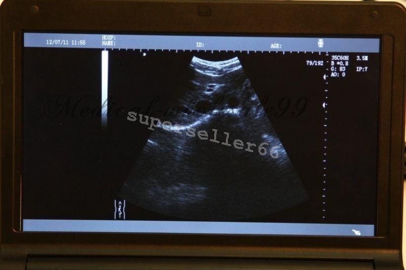 Ultrasound Scanner 10.1'' LCD B Ultrasonic Machine + Transvaginal ,Linear Probe DIAGNOSTIC ULTRASOUND MACHINES FOR SALE