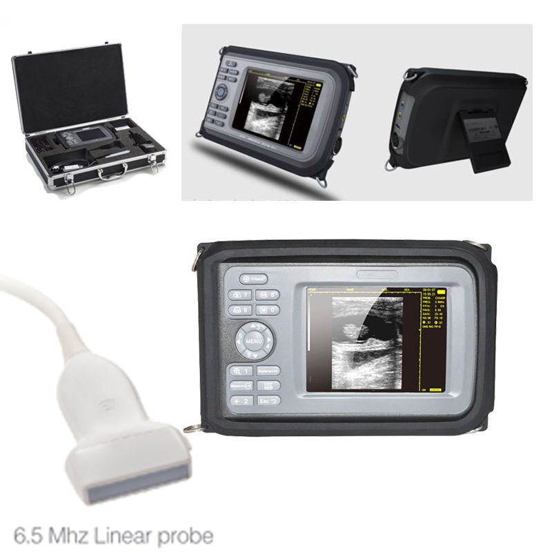 5.5'' TFT color LCD Palmtop Digital Ultrasound Scanner,Linear Probe,64 Images CE DIAGNOSTIC ULTRASOUND MACHINES FOR SALE