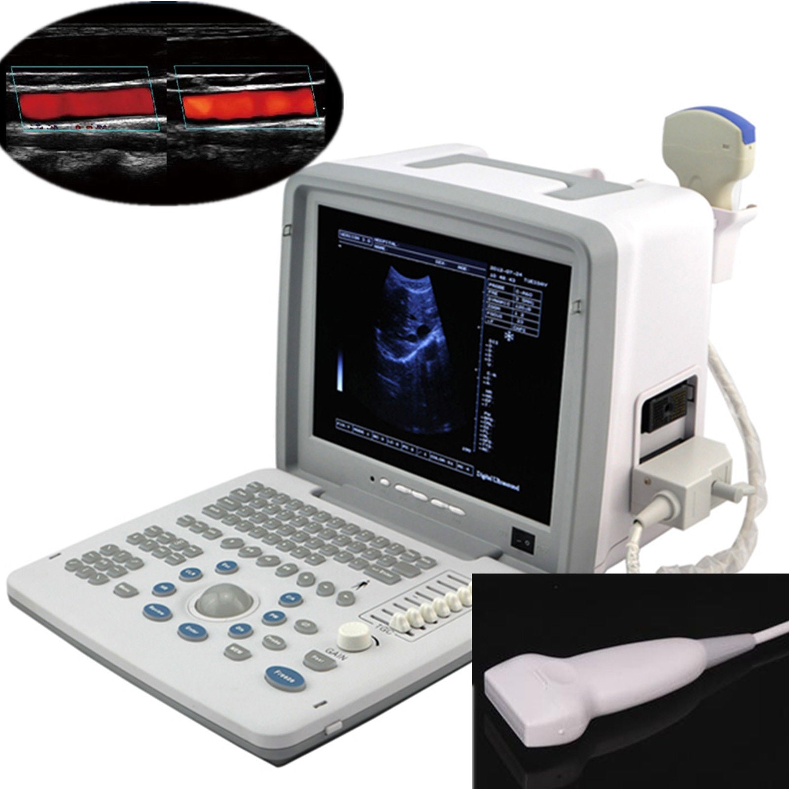 Top 12'' Digital Ultrasound Ultrasonic Scanner Convex Linear Probes+3D Software 190891976321 DIAGNOSTIC ULTRASOUND MACHINES FOR SALE