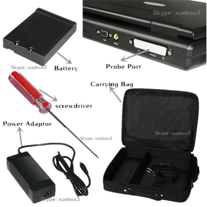 Portable laptop machine, Digital Ultrasound scanner, 3.5M Convex probe,US FedEx  658126883672 DIAGNOSTIC ULTRASOUND MACHINES FOR SALE