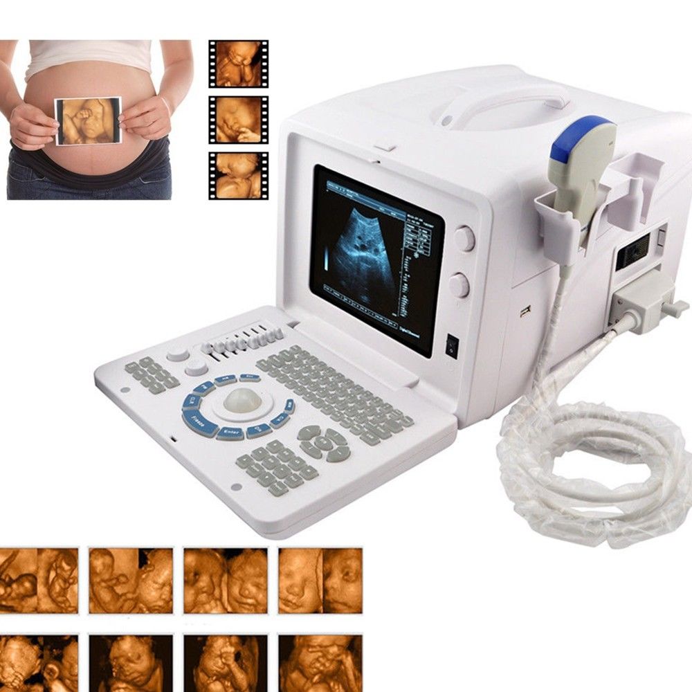 Digital Ultrasound machine Scanner  Convex + linear Probe +3D Worksation CE Sale 190891802941 DIAGNOSTIC ULTRASOUND MACHINES FOR SALE