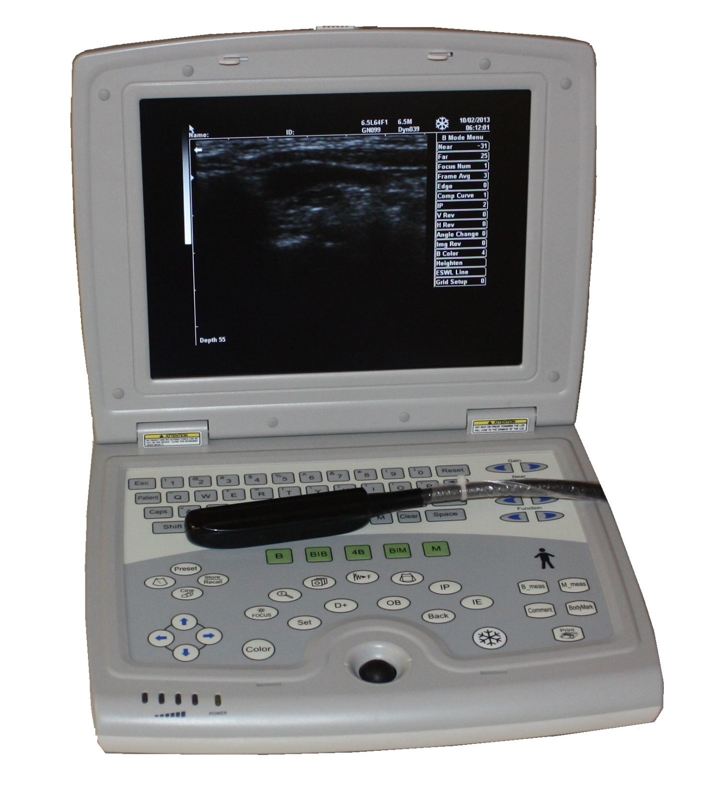 KX5000V Veterinary Laptop Ultrasound-Bovine/Horse&Rectal Insertion Arm-Keebomed DIAGNOSTIC ULTRASOUND MACHINES FOR SALE
