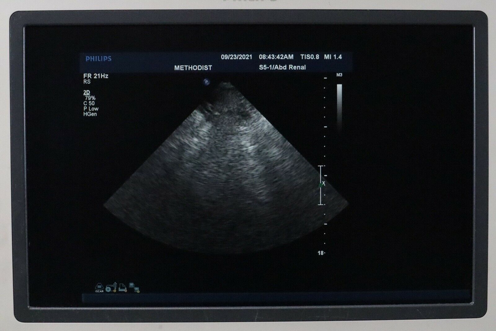 PHILIPS S5-1 SECTOR ARRAY ULTRASOUND PROBE DIAGNOSTIC ULTRASOUND MACHINES FOR SALE