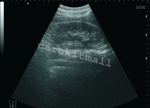 Laptop LCD Ultrasound Scanner Machine +Convex Linear Probe+Sony UP-897MD Printer 190891494573 DIAGNOSTIC ULTRASOUND MACHINES FOR SALE