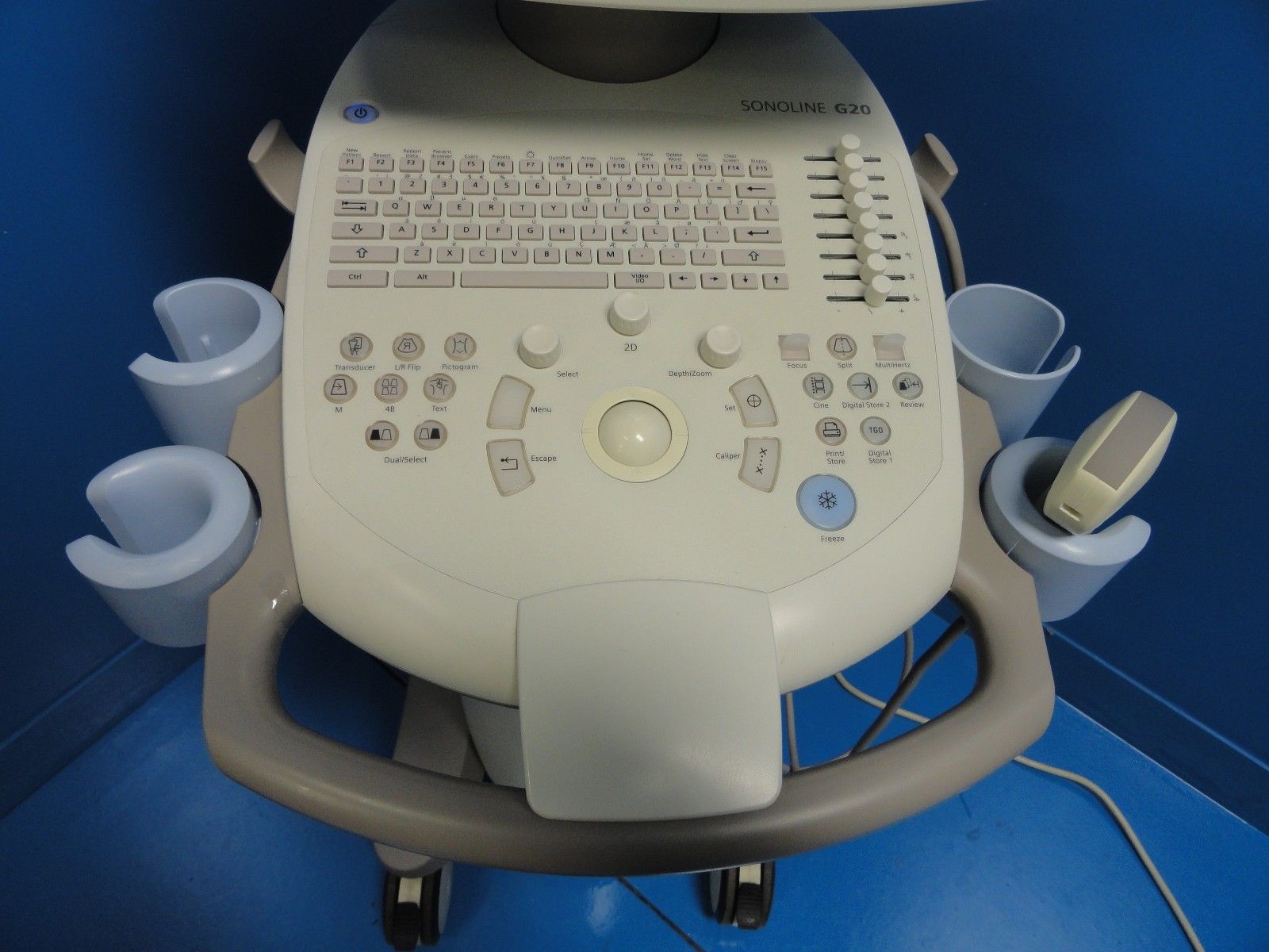 2005 Siemens Sonoline G20 Ultrasound W/ C5-2 Convex Transducer & Printer (6937) DIAGNOSTIC ULTRASOUND MACHINES FOR SALE