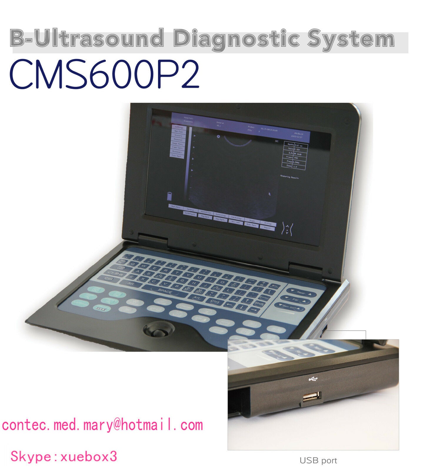 US-Digital-Portable-Ultrasound-Scanner-Machine+Cardiac+Convex Two probes  Sale. DIAGNOSTIC ULTRASOUND MACHINES FOR SALE