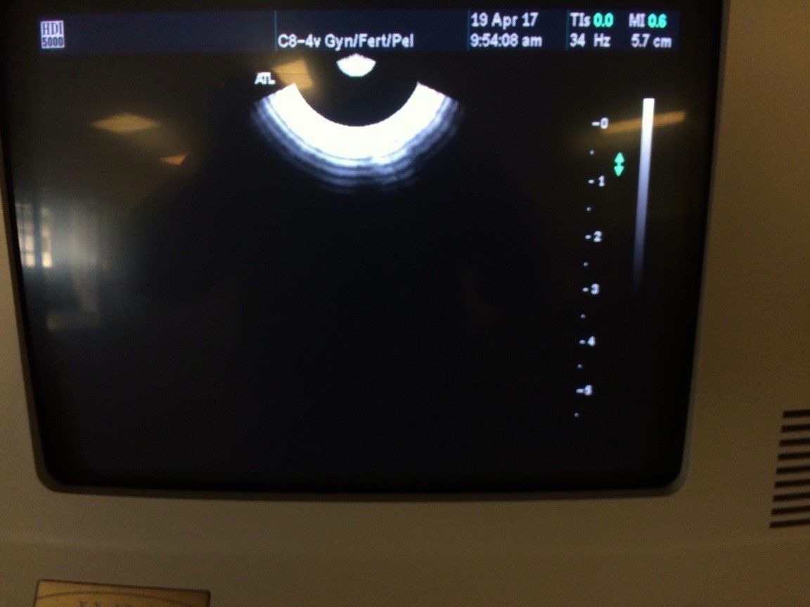 ATL HDI 5000 CV Ultrasound w/ 3 Probes DIAGNOSTIC ULTRASOUND MACHINES FOR SALE