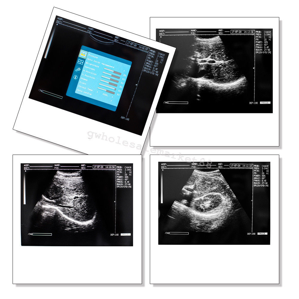 Ultrasound Machine Laptop Ultrasound Scanner Convex probe 3D Software 30% off 190891045898 DIAGNOSTIC ULTRASOUND MACHINES FOR SALE