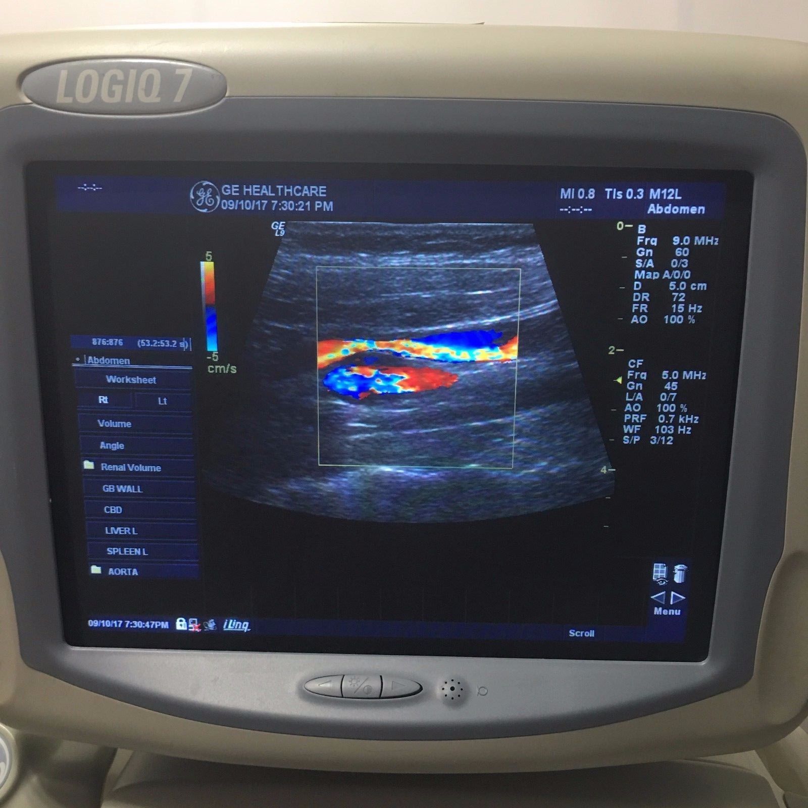 GE Logiq 9 Ultrasound System with 3.5C, E8C, 7L, 10L, and M12L  Transducers DIAGNOSTIC ULTRASOUND MACHINES FOR SALE