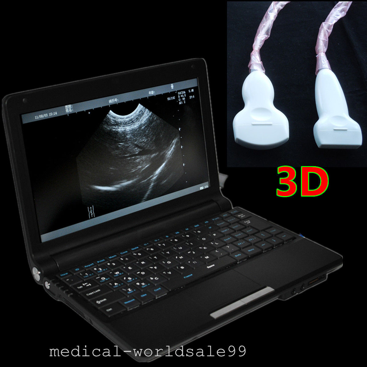Digital Laptop Machine Ultrasound Scanner +Convex& Vignal &Linear 3 Probe &3D DIAGNOSTIC ULTRASOUND MACHINES FOR SALE