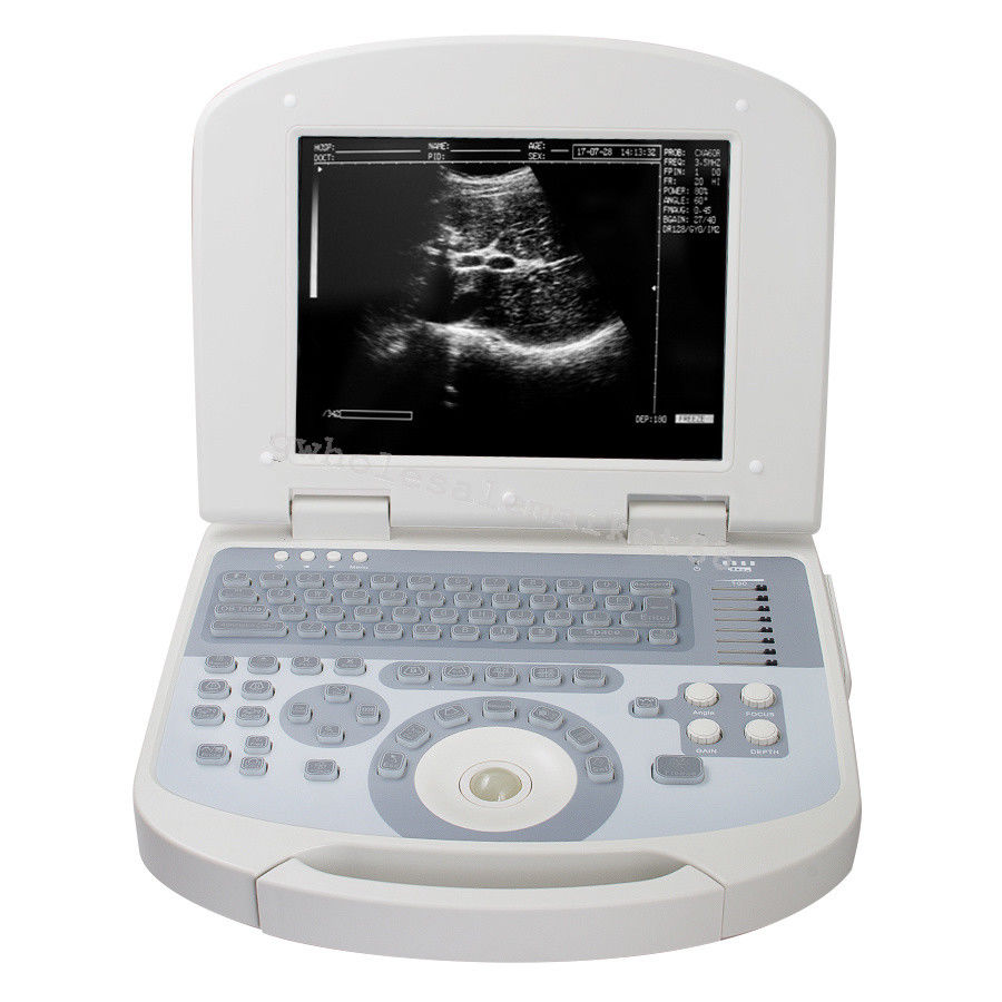 US Hot Portable Ultrasound Machine Scanner System Convex probe 3D Software Image 190891045898 DIAGNOSTIC ULTRASOUND MACHINES FOR SALE