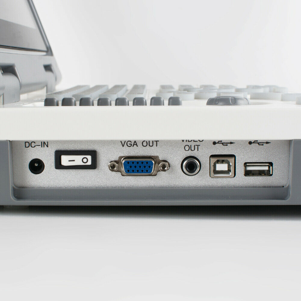 Portable Laptop Digital Ultrasound Scanner Machine System +Convex Probe +Battery DIAGNOSTIC ULTRASOUND MACHINES FOR SALE