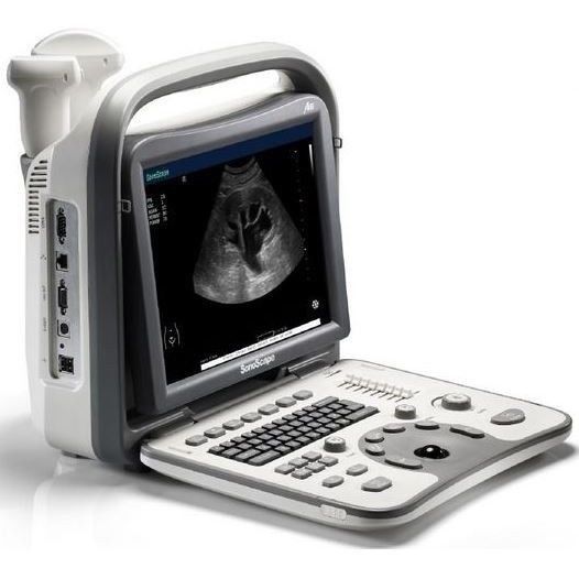 SonoScape A6 Portable Ultrasound Machine DIAGNOSTIC ULTRASOUND MACHINES FOR SALE