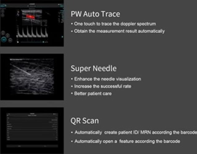 Supper Small Chison SonoEye  P1 Linear Array for android Color Doppler Vascular DIAGNOSTIC ULTRASOUND MACHINES FOR SALE